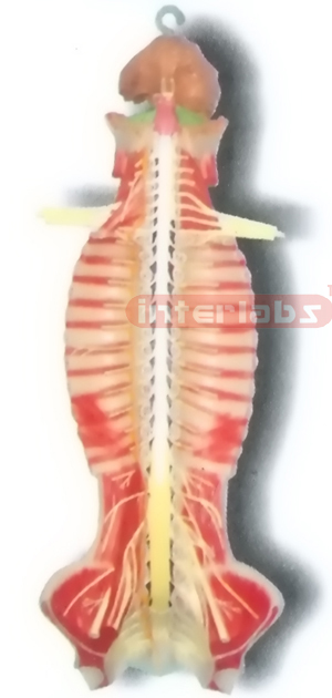 HITCH-HANGING, HUMAN SPINAL CORD MODEL IN SPINAL CANAL